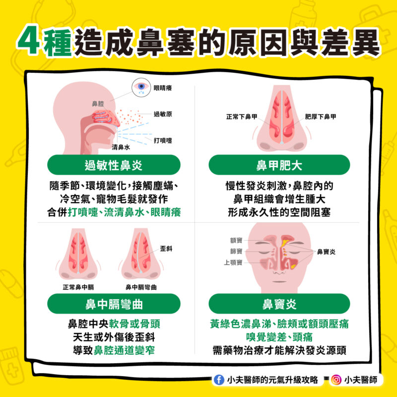 鼻塞原因 類型